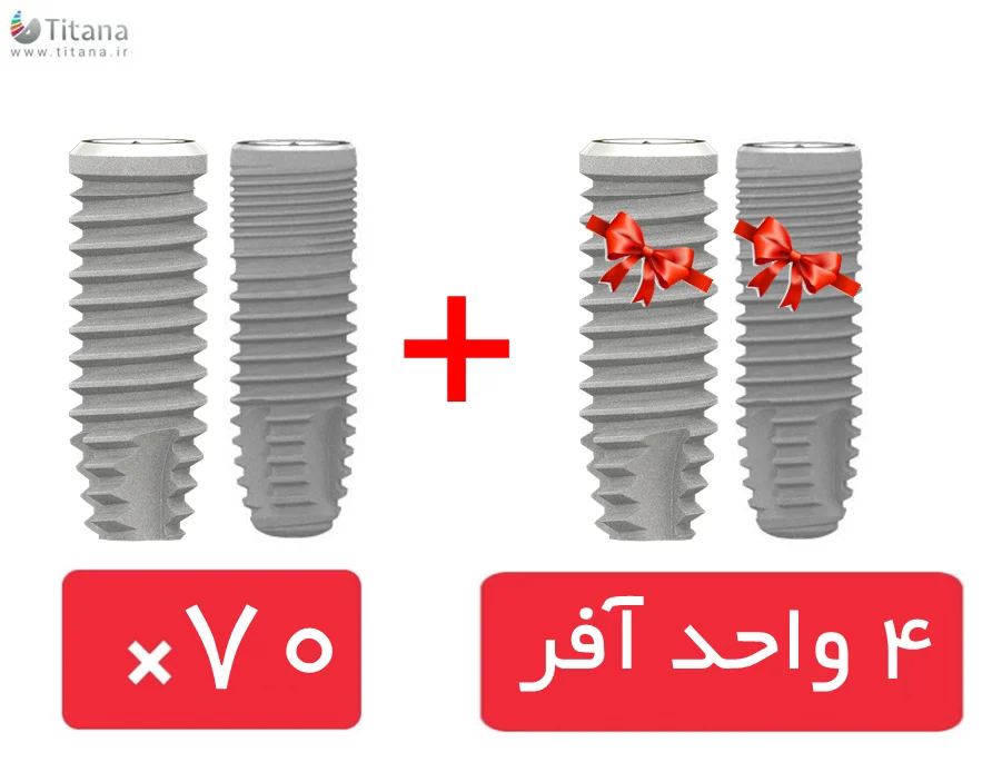 پکیج 70 واحد فیکسچر SIC ایس(ace) و مکس(max) با آفر 4 واحد فیکسچر رایگان