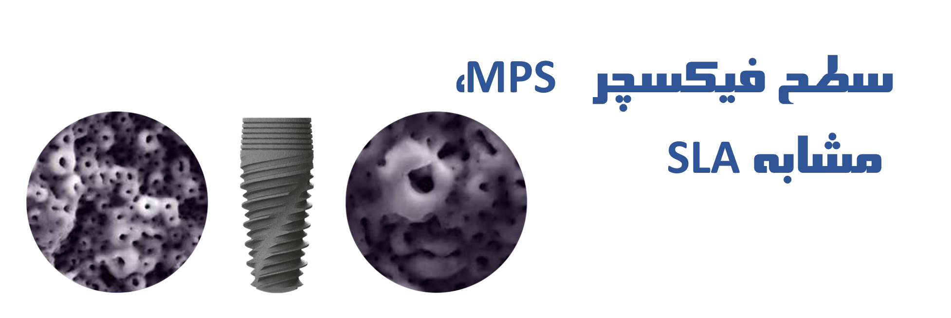 عکس سطح فیکسچر MPS  ، مشابه SLA