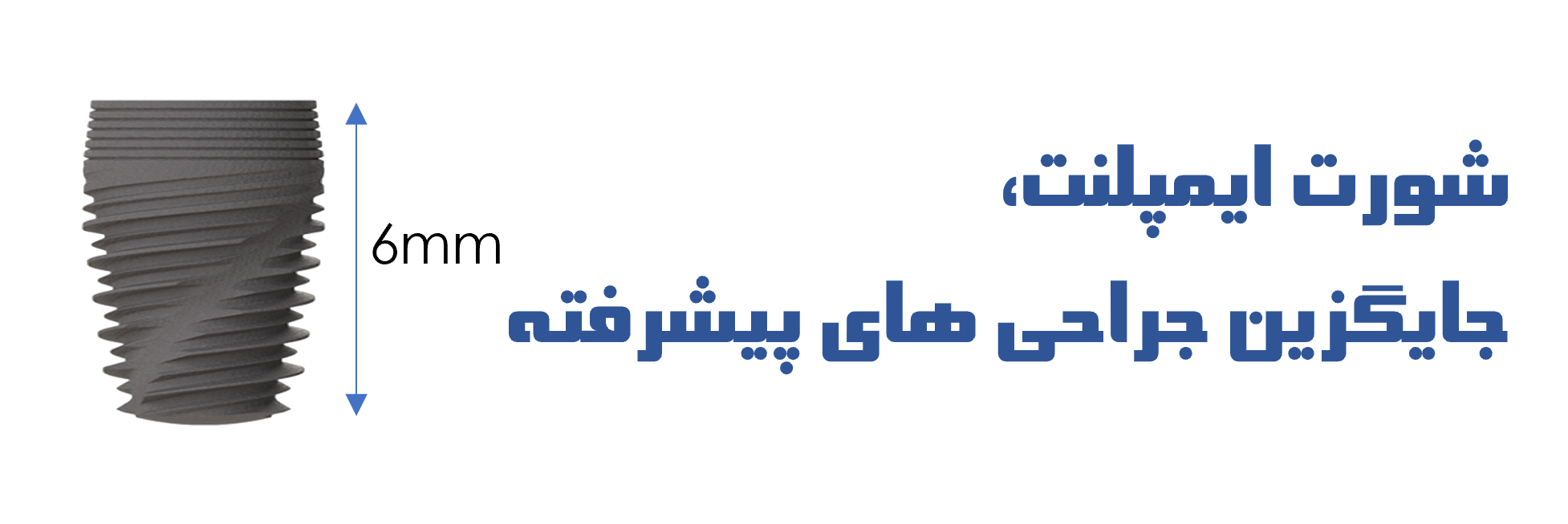 عکس شورت ایمپلنت نکسیس، جایگزین جراحی های پیشرفته