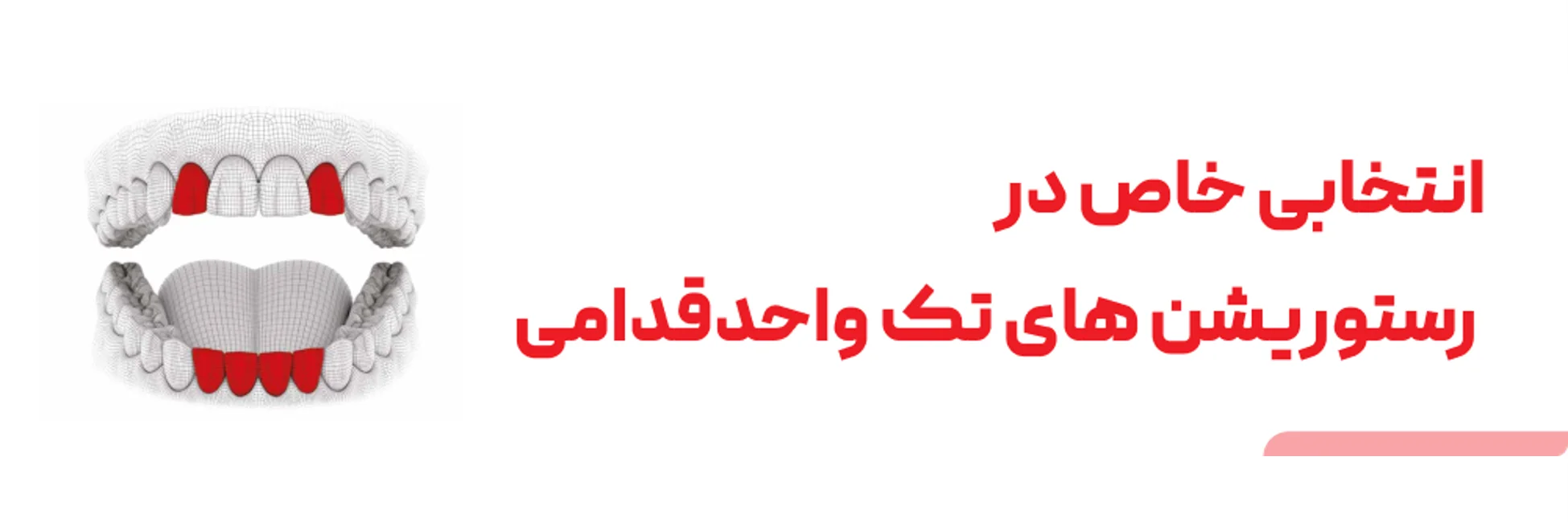 عکس فیکسچر با قطر 2.9  در رستوریشن های تک واحد قدامی