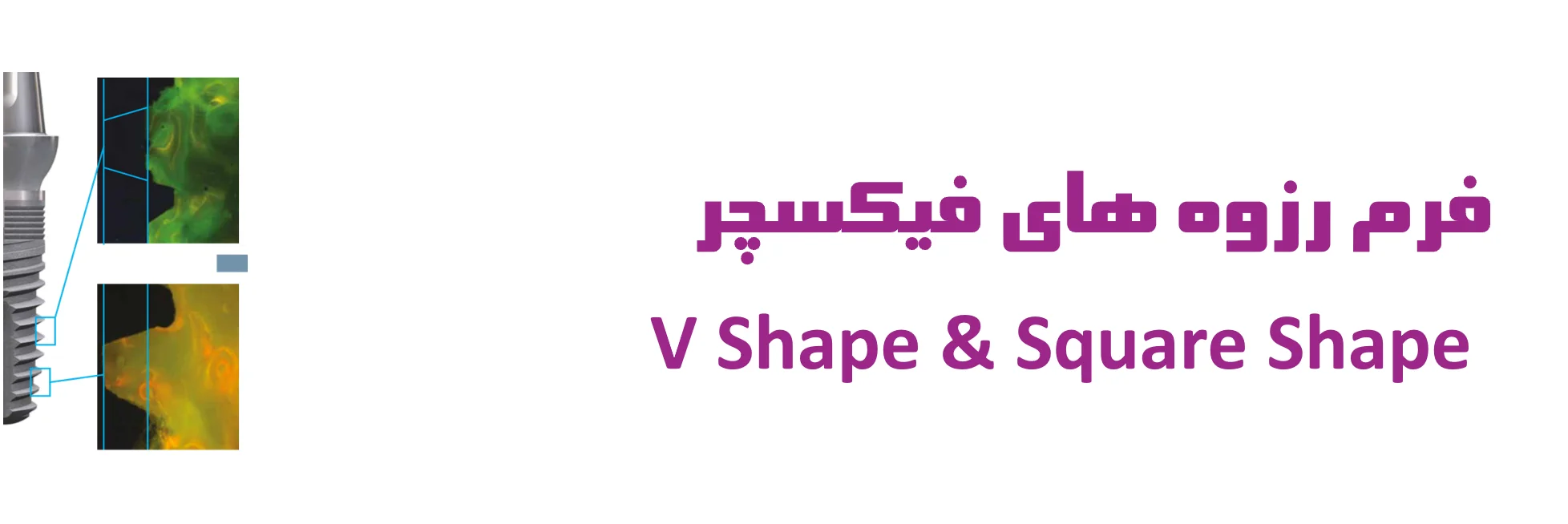 عکس فرم رزوه های فیکسچر V Shape & Square Shape