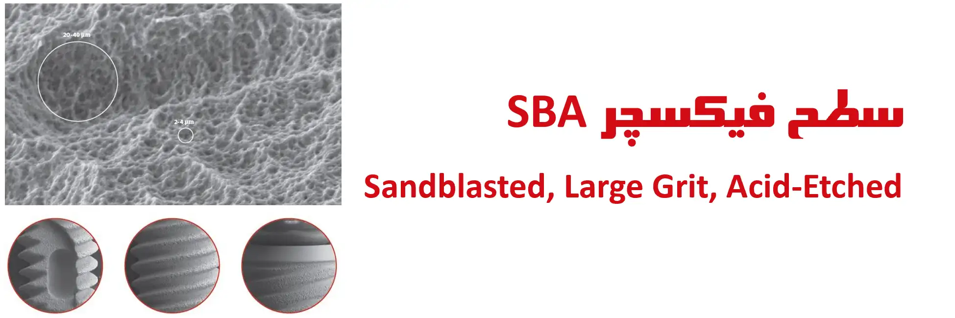 عکس سطح فیکسچر SBA Sandblasted, Large Grit, Acid-Etched