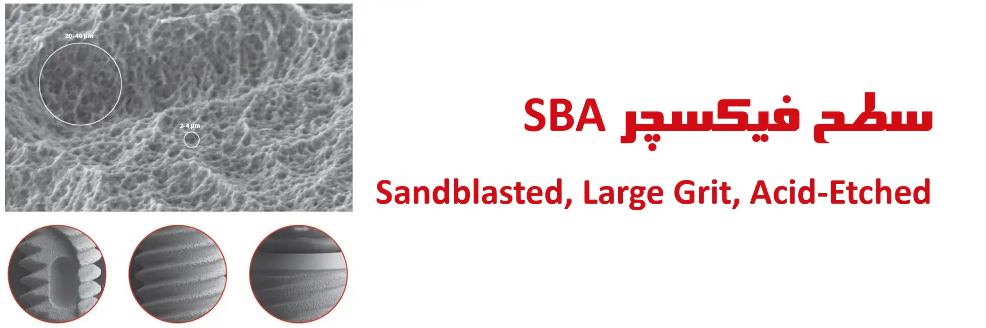 سطح فیکسچر SBA Sandblasted, Large Grit, Acid-Etched